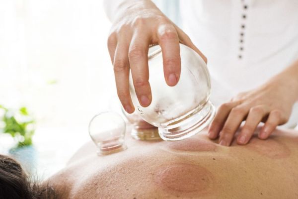 someone undergoing a cupping procedure 