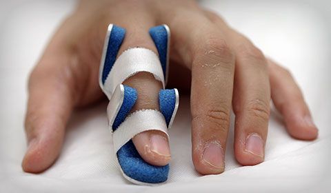 finger splint in place