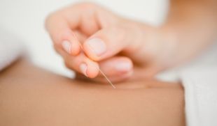 needle therapy being performed on a patient's back